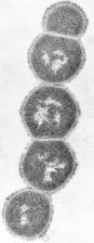 Image result for Group D Streptococcus