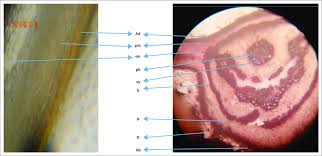 Image result for Isoberlinia tomentosa