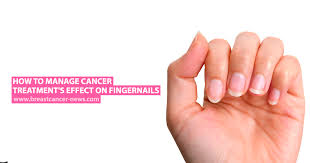 You could lower your risk of cancer signs by regularly checking your toes. How To Manage Cancer Treatment S Effect On Fingernails Breast Cancer News