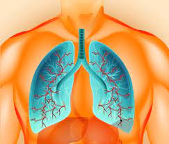 Últimas noticias, fotos, y videos de trombosis pulmonar las encuentras en trome.pe. Que Es Un Tep Tromboembolismo Pulmonar