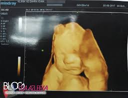 We did not find results for: Alhamdulillah Dah Scan Jantina Baby Baru Blog Lea Azleeya