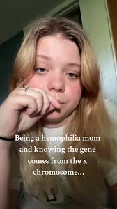 Hemophilia Feet David