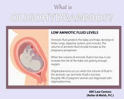 Oligohydramnios Low Amniotic Fluid Birth Injury Cases
