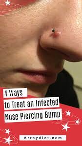 4 Things To Treat Infected Nose Piercing Bump Without Closing It Nose Piercing Bump Piercing Bump Nose Piercing