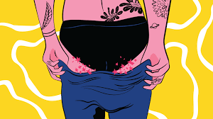 It's called jock itch because it's commonly seen in active kids who sweat a lot while playing sports. Inverse Psoriasis Or Jock Itch Symptoms Causes Treatment