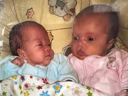 Dengang skiftede mor og far 35 bleer på én dag: 18-årige trillinger  tilhører sjælden klub