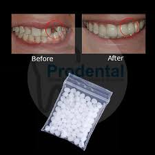 We did not find results for: Jual Temptooth Gigi Palsu Lem Gigi Padat Gigi Veneer Buat Sendiri Di Lapak Prodental Bukalapak