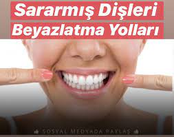 sararmis disleri beyazlatma yollari cilt bakimi cilt bakimi dogal cilt bakimi dogal cilt