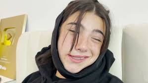 Brandon's Wisdom Teeth Removal Experience in Kennewick, WA