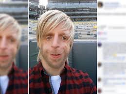 Bildet viser at personer med tricher collins syndrom ikke fører mindre aktive liv enn friske mennesker. Treacher Collins Syndrom Tragisches Schicksal Diese Erbkrankheit Entstellte Sein Gesicht Bunte De