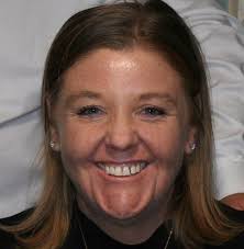 Where to find wheat, egg, gluten, buckwheat, barley, dairy, yeast and nut  free bread in NSW?