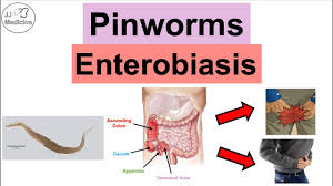 Image result for Pinworm