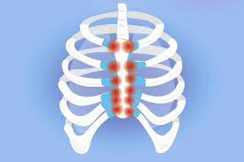 Rib pain or pain in the chest wall that feels like it comes from a rib may be caused by traumatic injury, muscle strain, joint inflammation, or chronic pain, and ranges in severity. Costochondritis And Arthritis Understanding Symptoms And Treatment