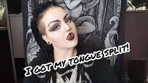 Getting my Tongue Split! (Procedure and healing)