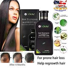 Eggs are a rich source of sulphur, iron, protein, phosphorus, iodine and zinc. Hair Care Shampoo Anti Hair Loss Hair Growth Shampoo Natural Ingredients Organic Featuring Mint Tea T Anti Hair Loss Shampoo Anti Hair Loss Hair Loss Shampoo