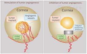Image result for Angiogenesis