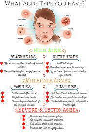 Acnevulgaris Acnetypes Read About Various Types Of Acne Vulgaris And Tips To Remove Them On Http Pimplere Acne Vulgaris Types Of Acne Cystic Acne Treatment
