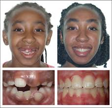 Canted Smile Guide: 7 Reasons For The Unaesthetic Canted Smile And What  Cosmetic Dentists Can Do To Treat Them