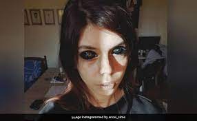 The reason that many people get this done is because of the aesthetic look and probable improvement of eyesight too, many different techniques and methods exist to get an eyeball tattoo along with different safety and concerns options that determine the success of this process. Model Loses Eyesight After Getting Eyeballs Tattooed Black