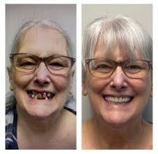 Rocky Mountain Smiles P.C.