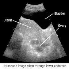 I had an ultrasound last friday where i was 6 weeks exactally. Ultrasound Guide Drugs Com