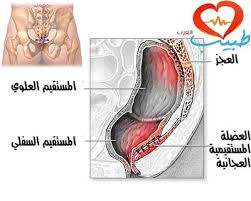 هبوط المستقيم أو تدلي الشرج rectal prolapse هبوط المستقيم بالصور