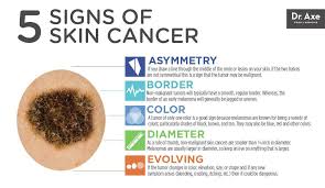 Nodular basal cell cancers can look see. Pin On Health Wellbeing