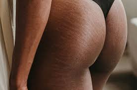 Even if a new line of clothing is the latest fad in other countries, it may not sell so well in brazil if the residents don't find it appealing. Brazilian Butt Lift Po Vergrosserung In Zurich Dr Med Thomas Biesgen