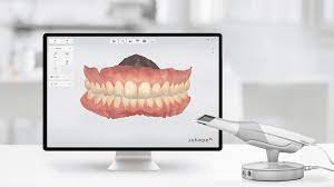 3shape scanner von 2009 und älter. 3shape Trios 3 Basic Digitaler Dentalscanner Fur Die Anfertigung Von Abdrucken