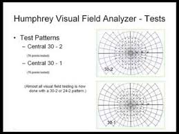 visual fields and humphrey visual field interpretation as in