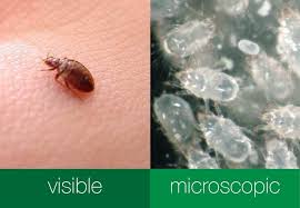 Image result for Cimex lectularius bites