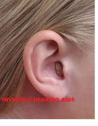 Check spelling or type a new query. Siemens And Invisible Hearing Aid Siemens Hearing Aid Id 10986323155
