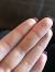 Guinness World Record Longest Ingrown Hair