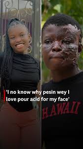 One girl tell me say vampire don fine pass me" Blessing Chinedu say na di  pesin wey she love and di papa of her children pour am acid for face. She  tell
