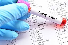 Allergy test cost in bangalore. Allergy Testing In Singapore Ear Allergy Clinic