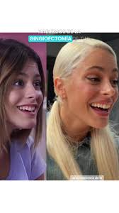 Tini Stoessel: Todo sobre su nueva operación y vida