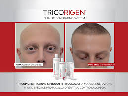 Formation Tricorigen par Toni Belfatto
