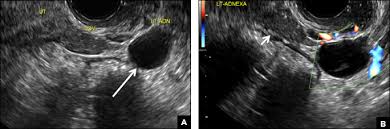 Pelvic sonography is the imaging modality of choice for evaluating the female pelvis. 32 Year Old Woman With Pelvic Pain And Irregular Menstrual Periods Mdedge Obgyn