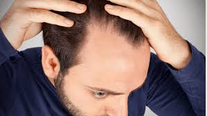 Presenting haircuts and tips for men with a receding hairline, including buzz cuts, taper fades, crew cuts, comb overs, and more. Best Hairstyles For Receding Hairline In 2021 Cyclops Brand