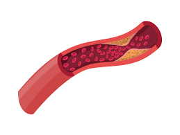 There are controllable and uncontrollable risk factors of heart diseases, but along with these diseases, the field of medicine is introducing new technologies. Circulatory System Diseases And Disorders Advanced Read Biology Ck 12 Foundation