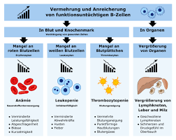 Chronische Lymphatische Leukamie Wikipedia