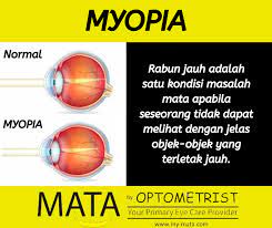 If you have documents, a website, an app, or anything else that requires a thorough. Rabun Jauh In English Almariki