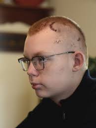 Mansfield Senior High freshman home for Christmas after brain surgery