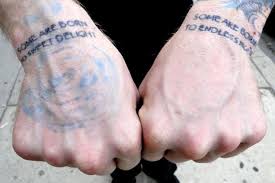 Although tca (trichloroacetic acid) does remove a tattoo, it should not be a method used by amateurs at home. Vamoose Tattoo Removal Shop Joins Damen Avenue Strip In Bucktown Bucktown Chicago Dnainfo