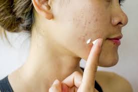 Buat sendiri review kamu di female daily. 10 Produk Skincare Yang Mengandung Retinol Terbaik 2021