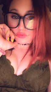 Does anyone have yellow dots