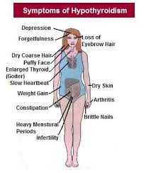 Subclinical Hypothyroidism Hypothyroidism Treatment Underactive Thyroid Hypothyroidism Natural Treatment