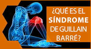 Barre syndrome as a cause of acute flaccid. Sindrome De Guillain Barre Informacion De Interes Sobre Diversidad Funcional Salud Y Bienestar