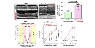Image result for Selective Estrogen Receptor Modulator