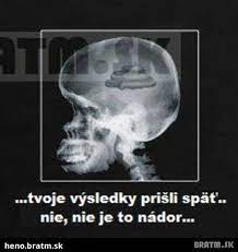 Vizera to byt dost mlade hovno ale holku dost pekne. Aj Tak Vies Iba VeÄ¾ke Hovno D Bratm Sk